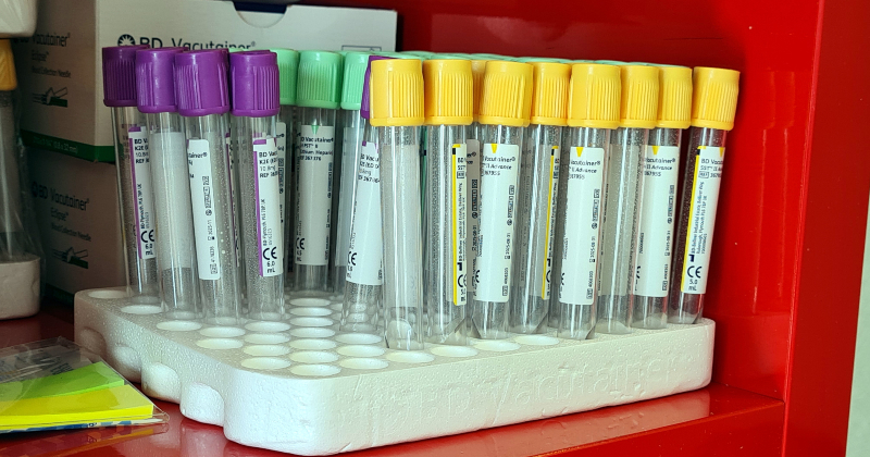 Pētījumā meklē jaunus veidus kuņģa un zarnu vēža agrīnai diagnostikai